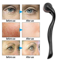 540 Derma Roller – Microneedle Roller for Hair Growth, Beard Care & Facial Skin Rejuvenation